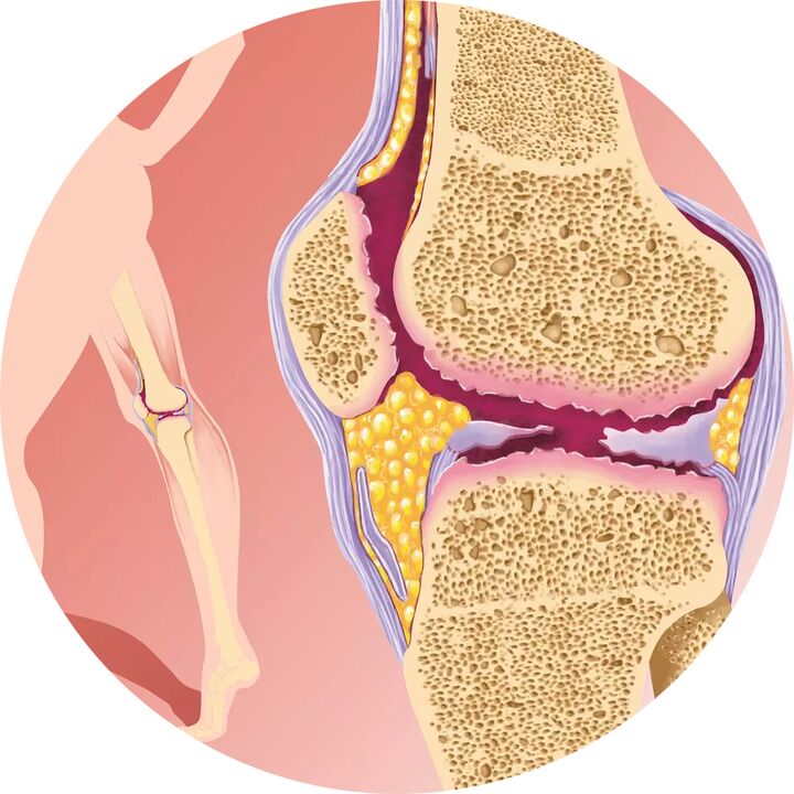 Hondroten – Toetab liigeste liikuvust